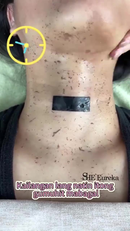 Gel Esfoliante Clareador para Remoção de Cravos - 50g (1/2 peças)